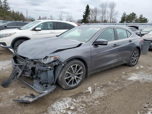 2017 Acura Tlx Tech