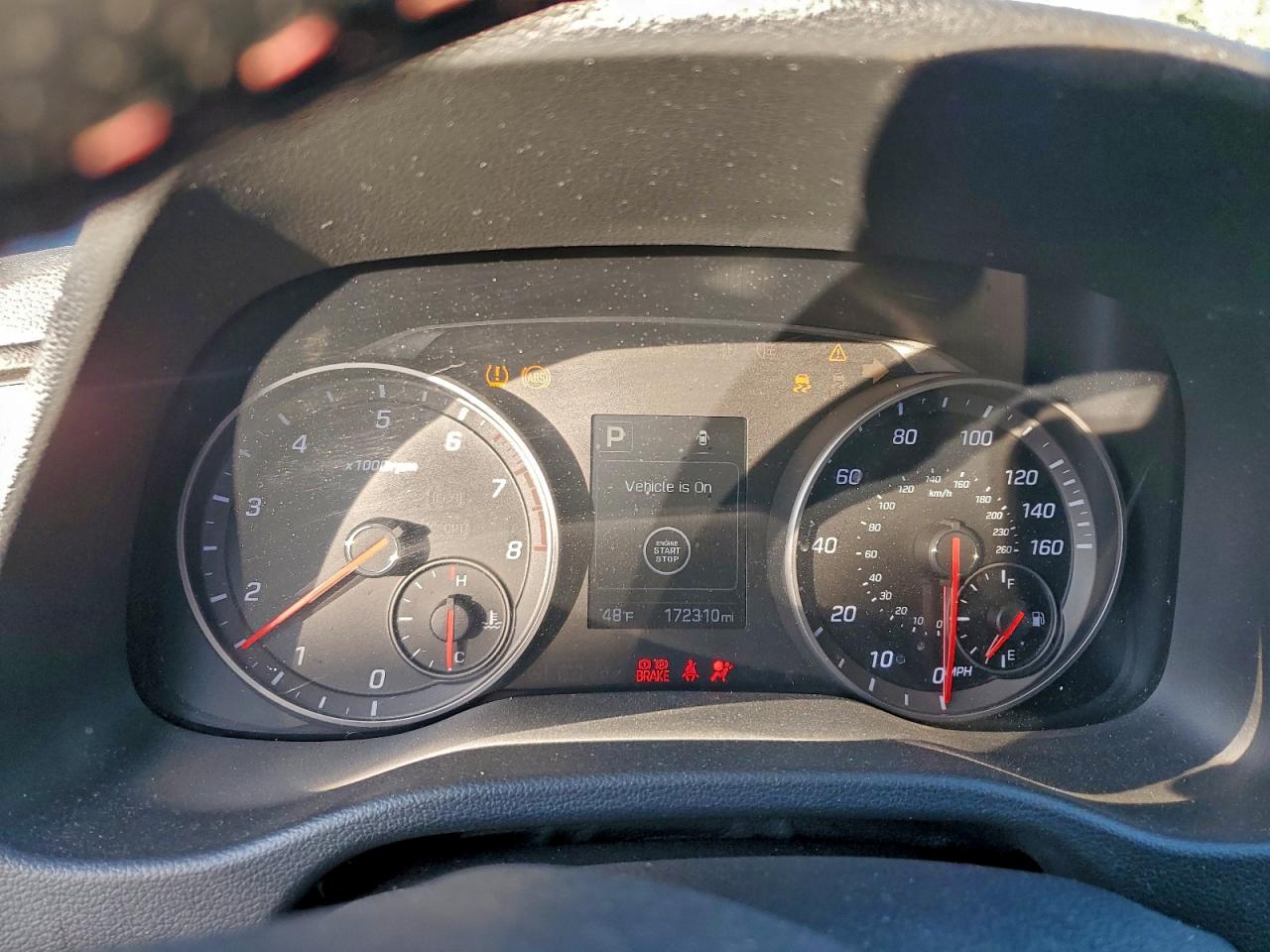 2017 Hyundai Elantra Sport VIN: KMHD04LB9HU291863 Lot: 95017395