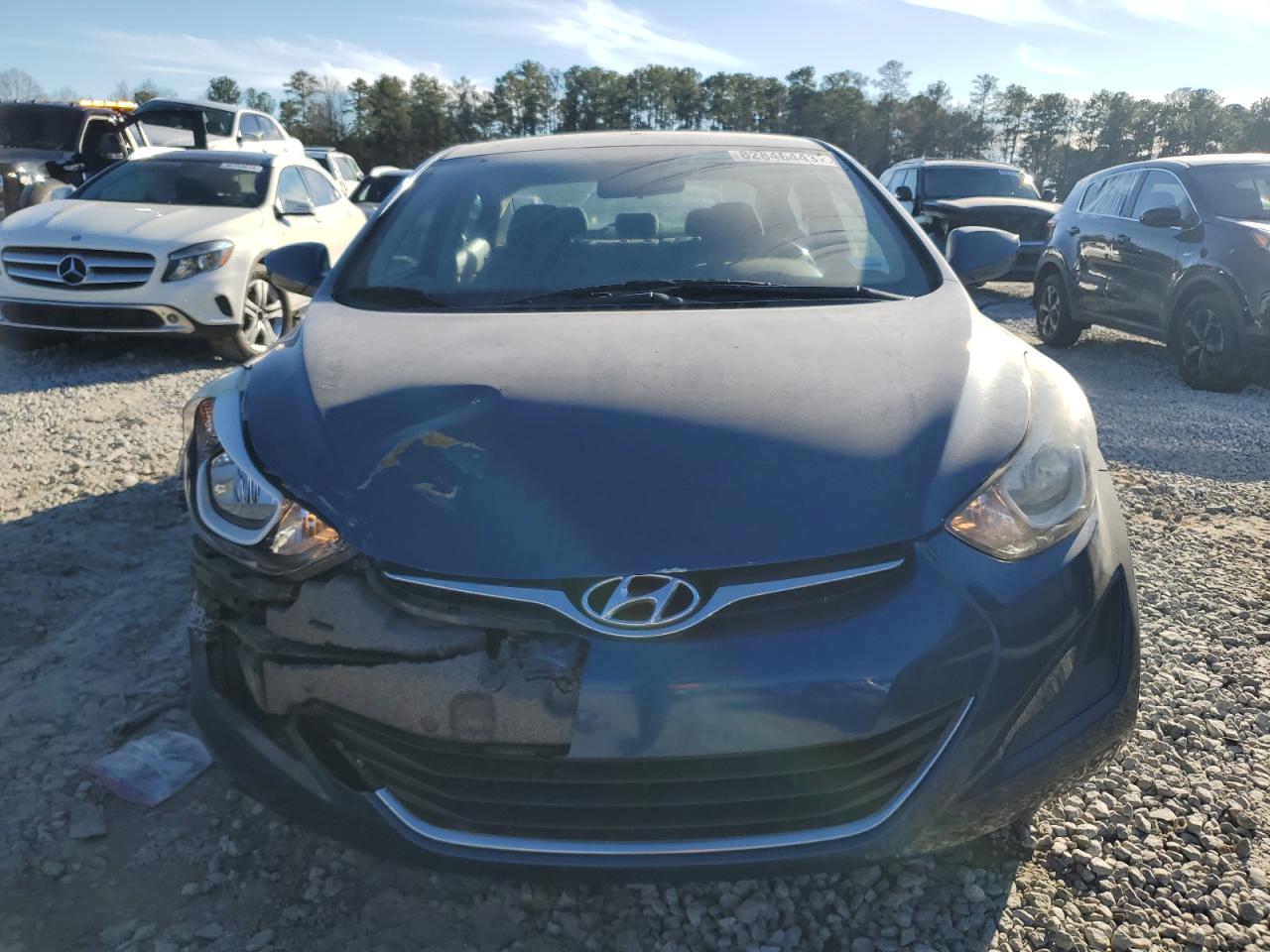 KMHDH4AE1GU651230 2016 Hyundai Elantra Se