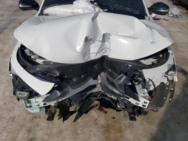 2025 BUICK ENVISTA SP KL47LBEP4SB051882