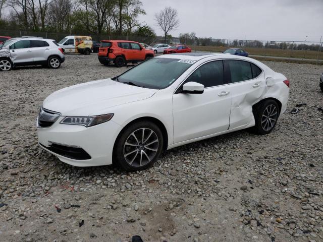 2017 Acura TLX Tech