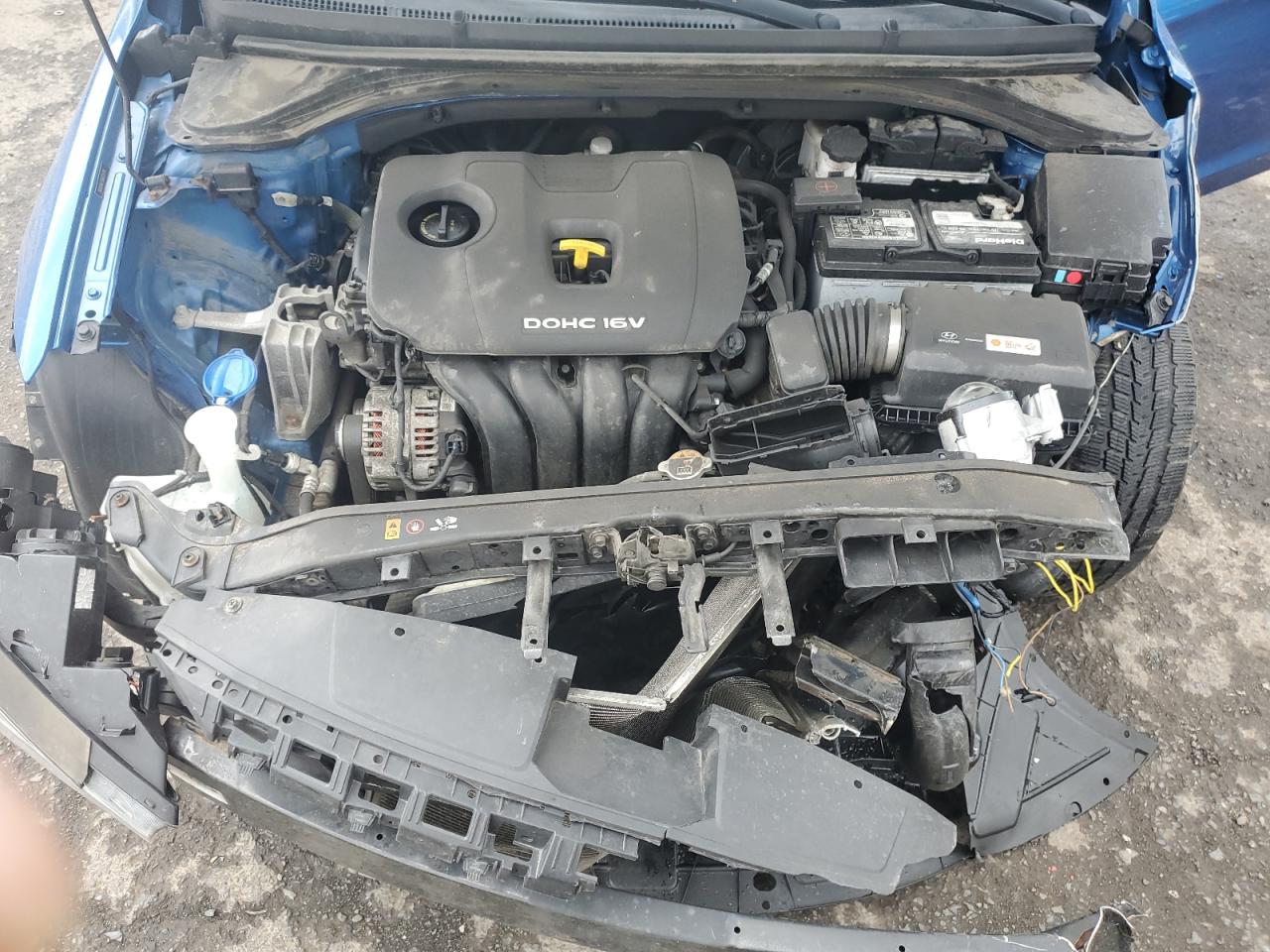 5NPD84LF9JH225314 2018 Hyundai Elantra Sel