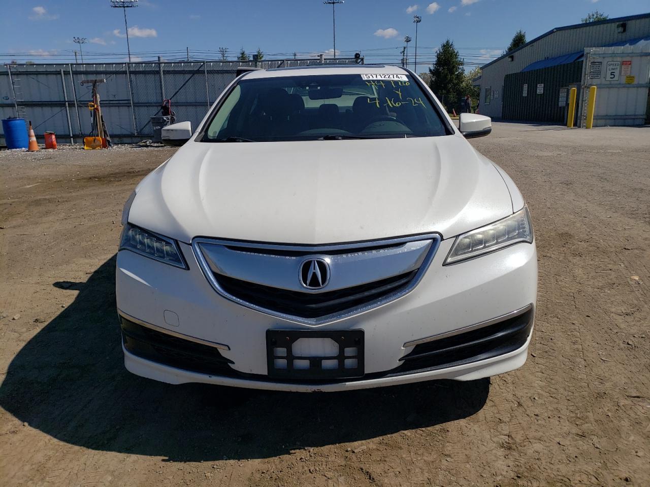 19UUB2F56HA001638 2017 Acura Tlx Tech