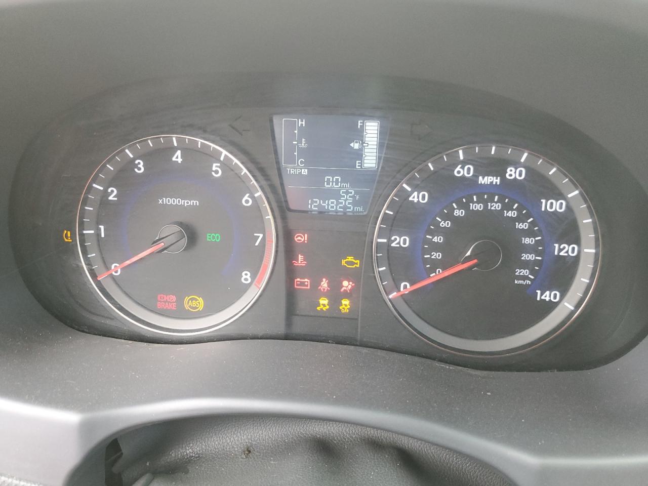 KMHCT4AE5HU252283 2017 Hyundai Accent Se