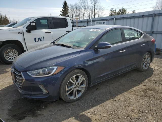 Vin: kmhd84lf8ju649164, lot: 51987485, hyundai elantra sel 2018 img_1