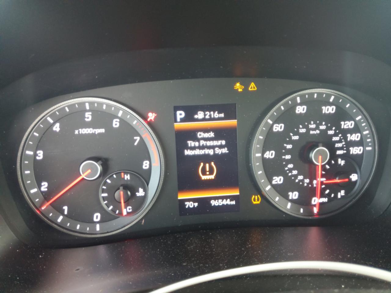 5NPE34AB4JH667162 2018 Hyundai Sonata Sport