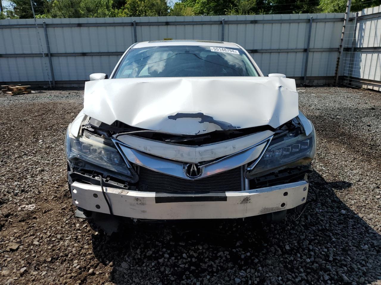 19UDE2F76HA005018 2017 Acura Ilx Premium