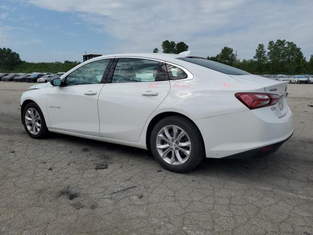2020 Chevrolet Malibu - Image 2
