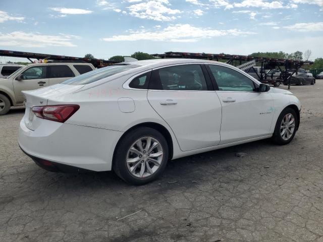 2020 Chevrolet Malibu - Image 3