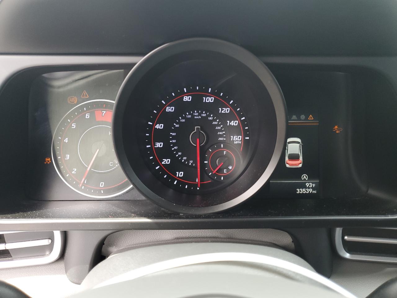 KMHLL4AG7NU309421 2022 Hyundai Elantra Se