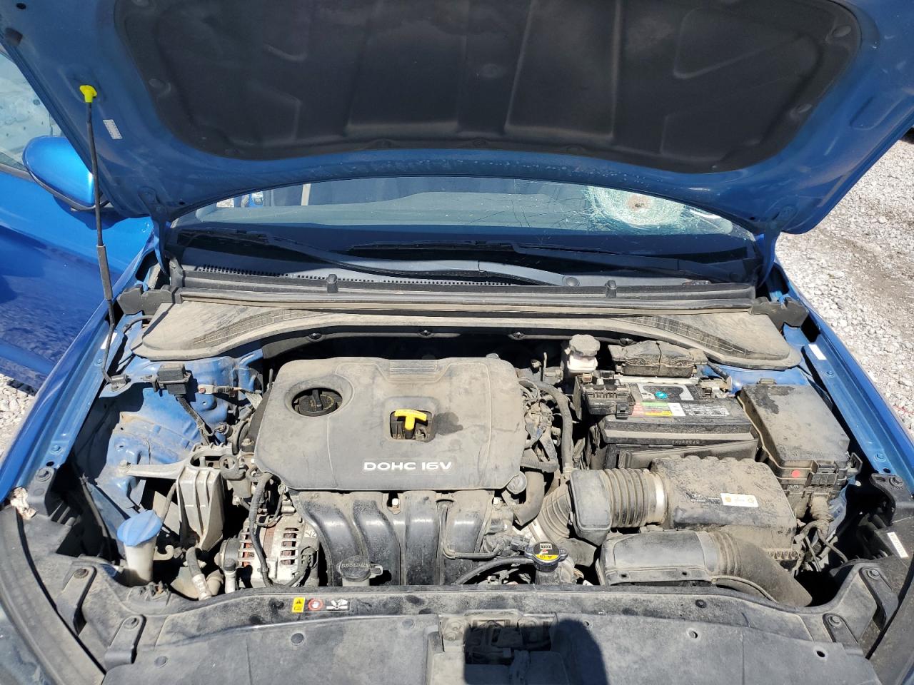 KMHD84LFXJU615663 2018 Hyundai Elantra Sel