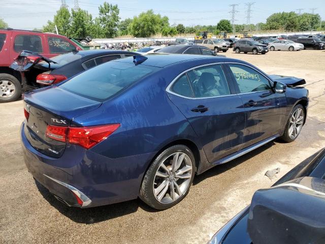 2019 ACURA TLX TECHNO - 19UUB3F47KA005928