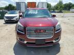 GMC ACADIA DEN photo