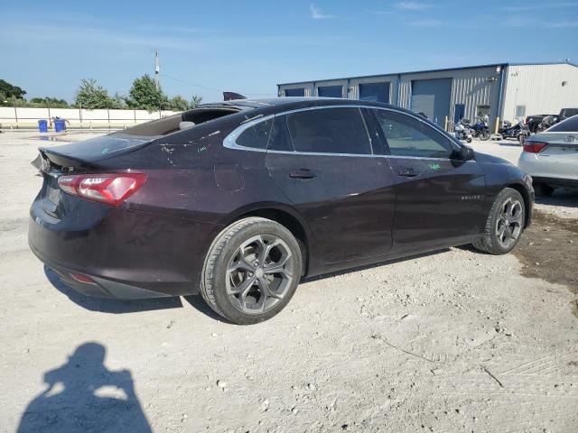 2021 Chevrolet Malibu - Image 3