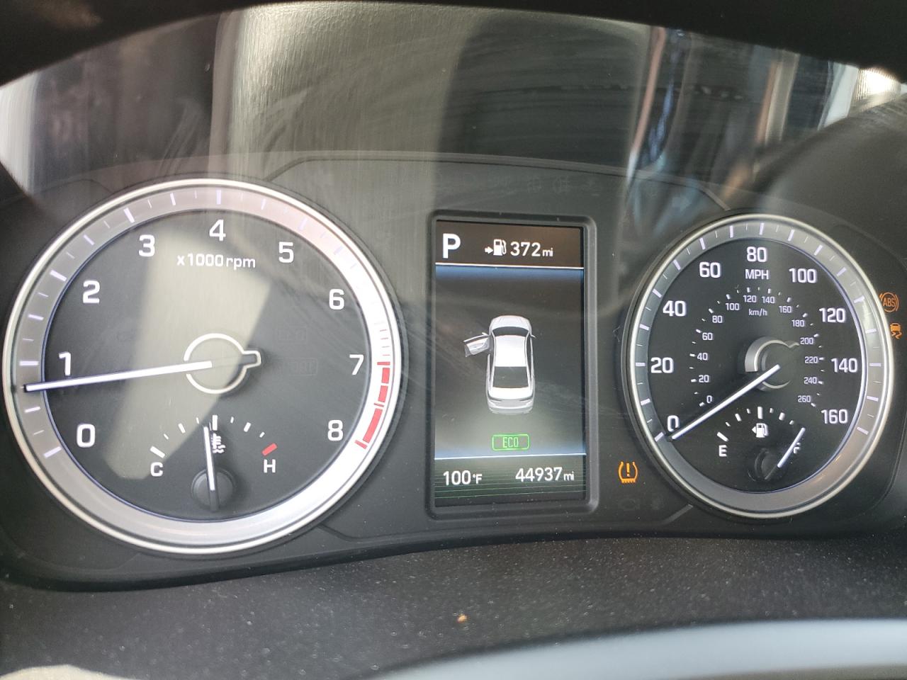 5NPE34AF9JH658797 2018 Hyundai Sonata Sport