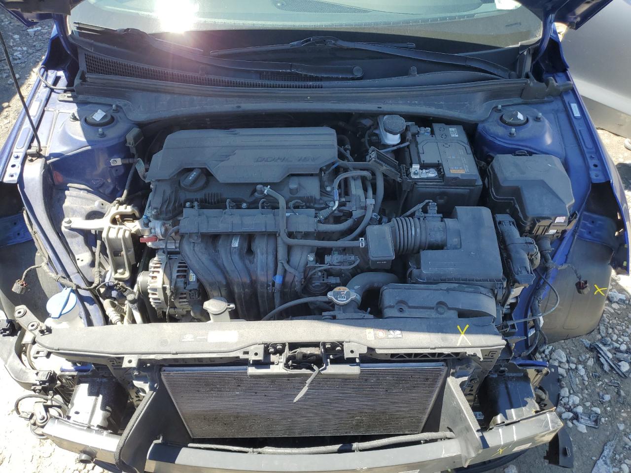 KMHLS4AG0NU296644 2022 Hyundai Elantra Sel