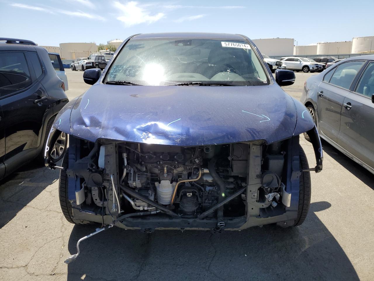 5FRYD3H41FB009976 2015 Acura Mdx Technology