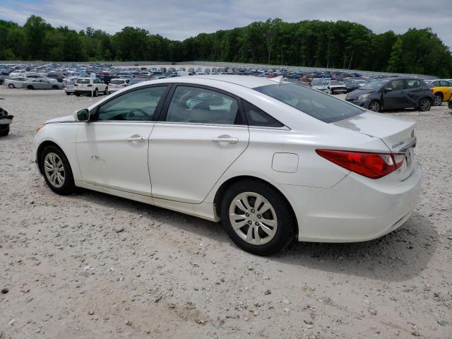 5NPEB4AC9DH573665 | 2013 Hyundai sonata gls