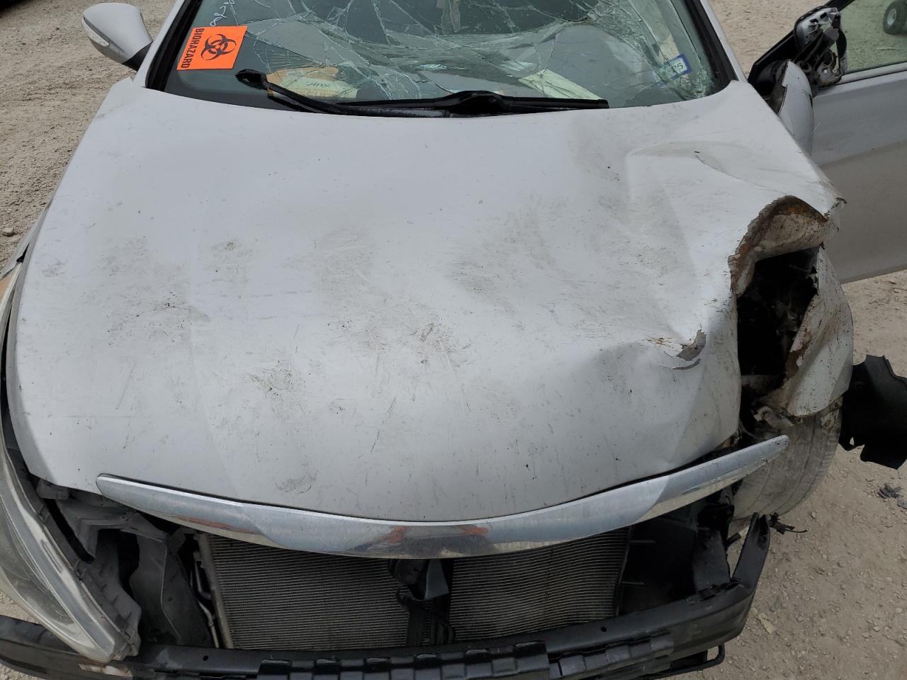 5NPEC4AC5EH910735 2014 Hyundai Sonata Se