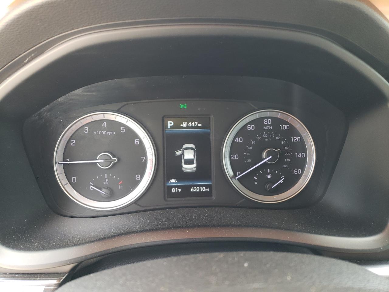 5NPE34AFXJH598576 2018 Hyundai Sonata Sport