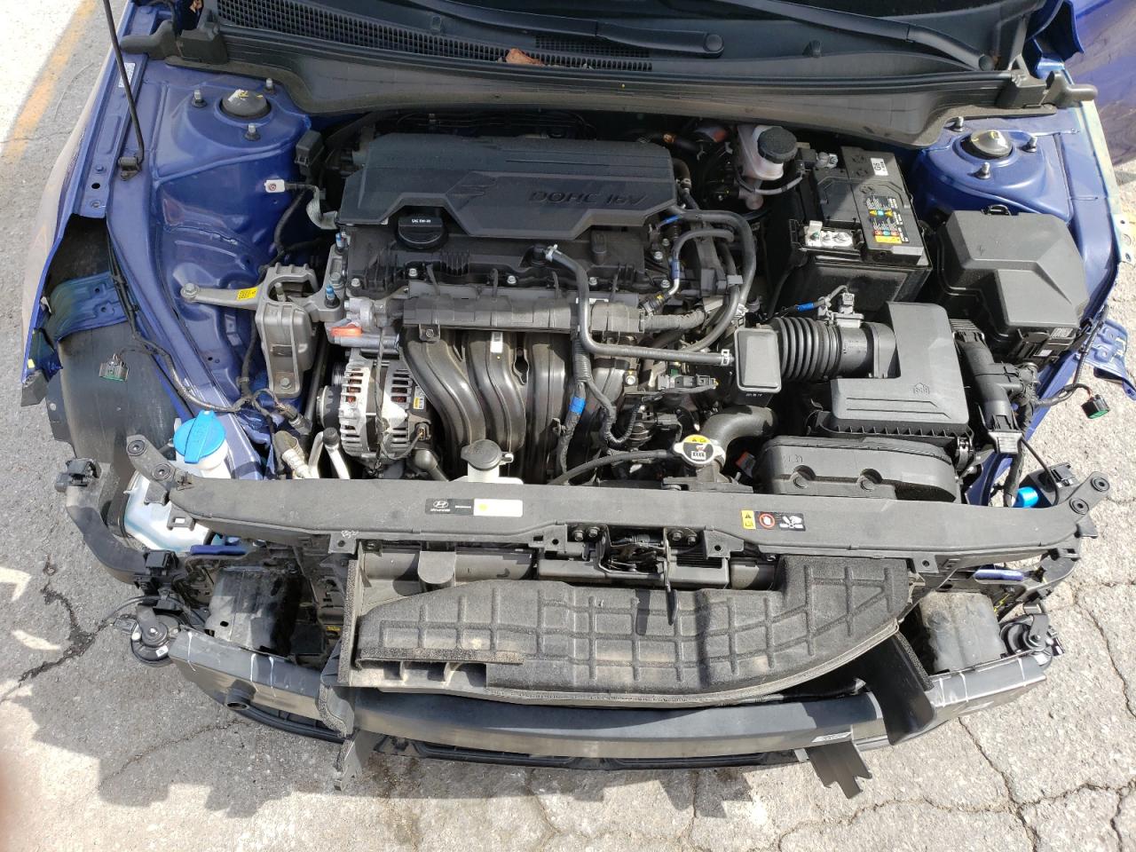 KMHLM4AG4NU224596 2022 Hyundai Elantra Sel