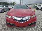 ACURA TLX TECH photo