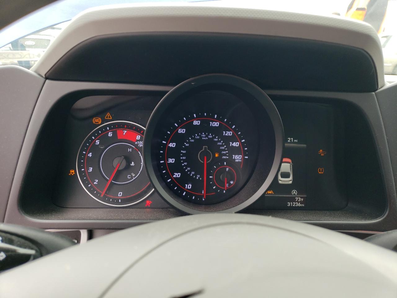 KMHLL4AG5NU238669 2022 Hyundai Elantra Se