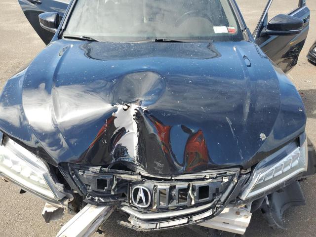 2015 ACURA TLX TECH - 19UUB2F58FA004165