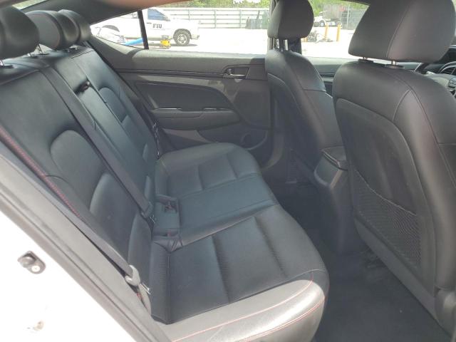2017 HYUNDAI ELANTRA SPORT KMHD04LB8HU355777