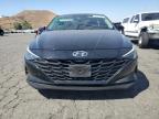 HYUNDAI ELANTRA BL photo