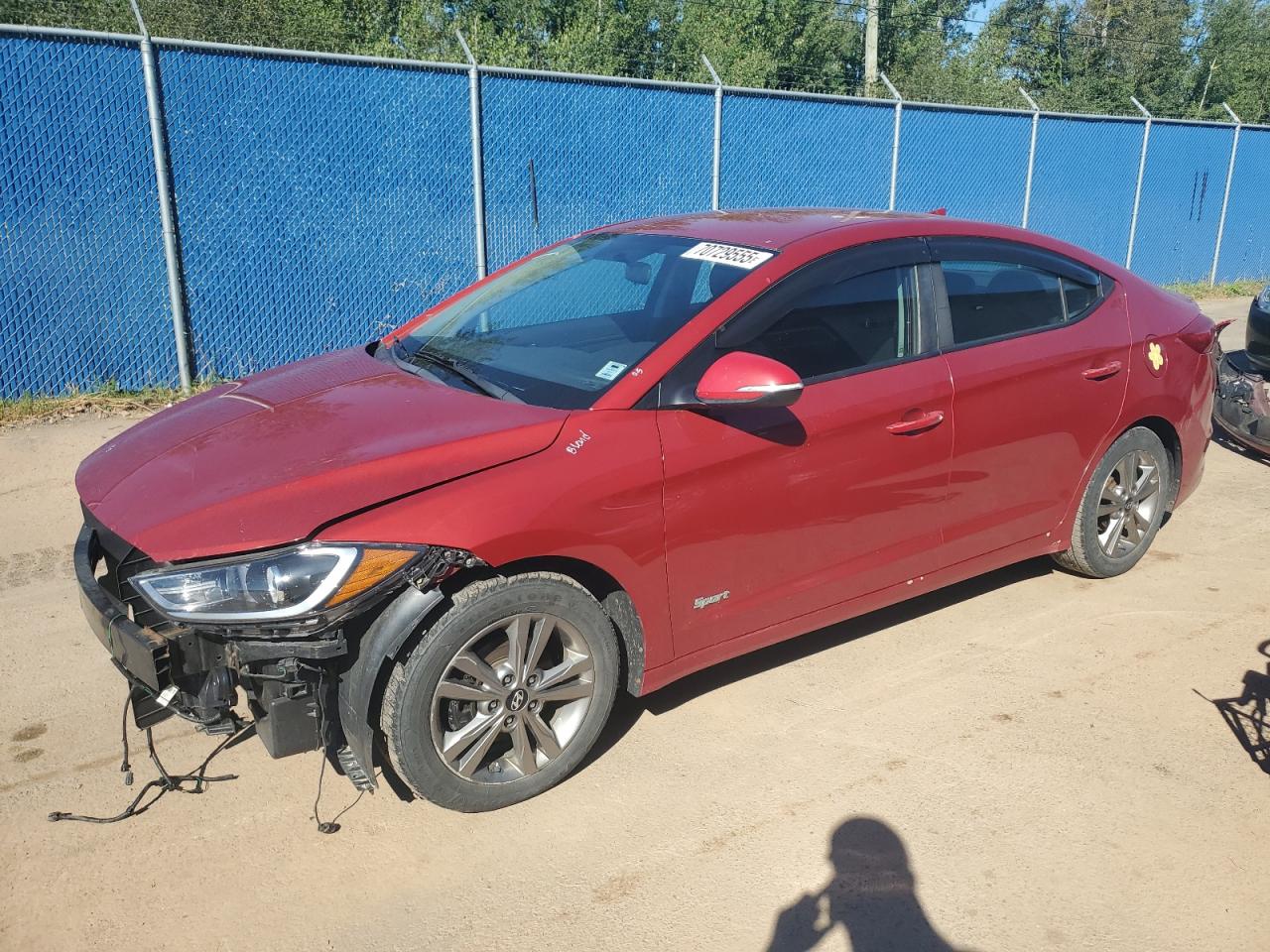 HYUNDAI ELANTRA SE