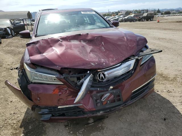 2015 ACURA TLX TECH - 19UUB1F55FA016865