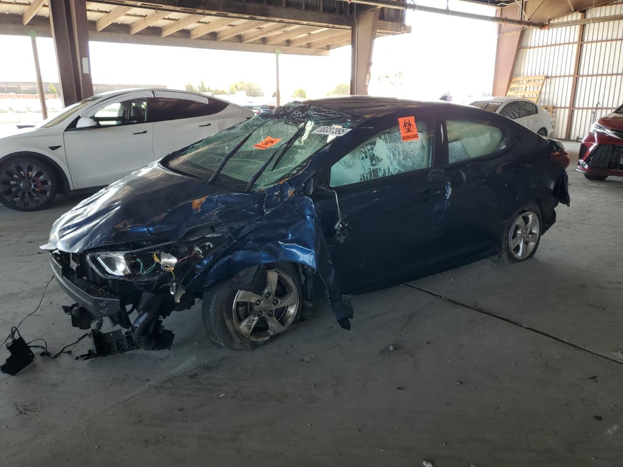 HYUNDAI ELANTRA SE