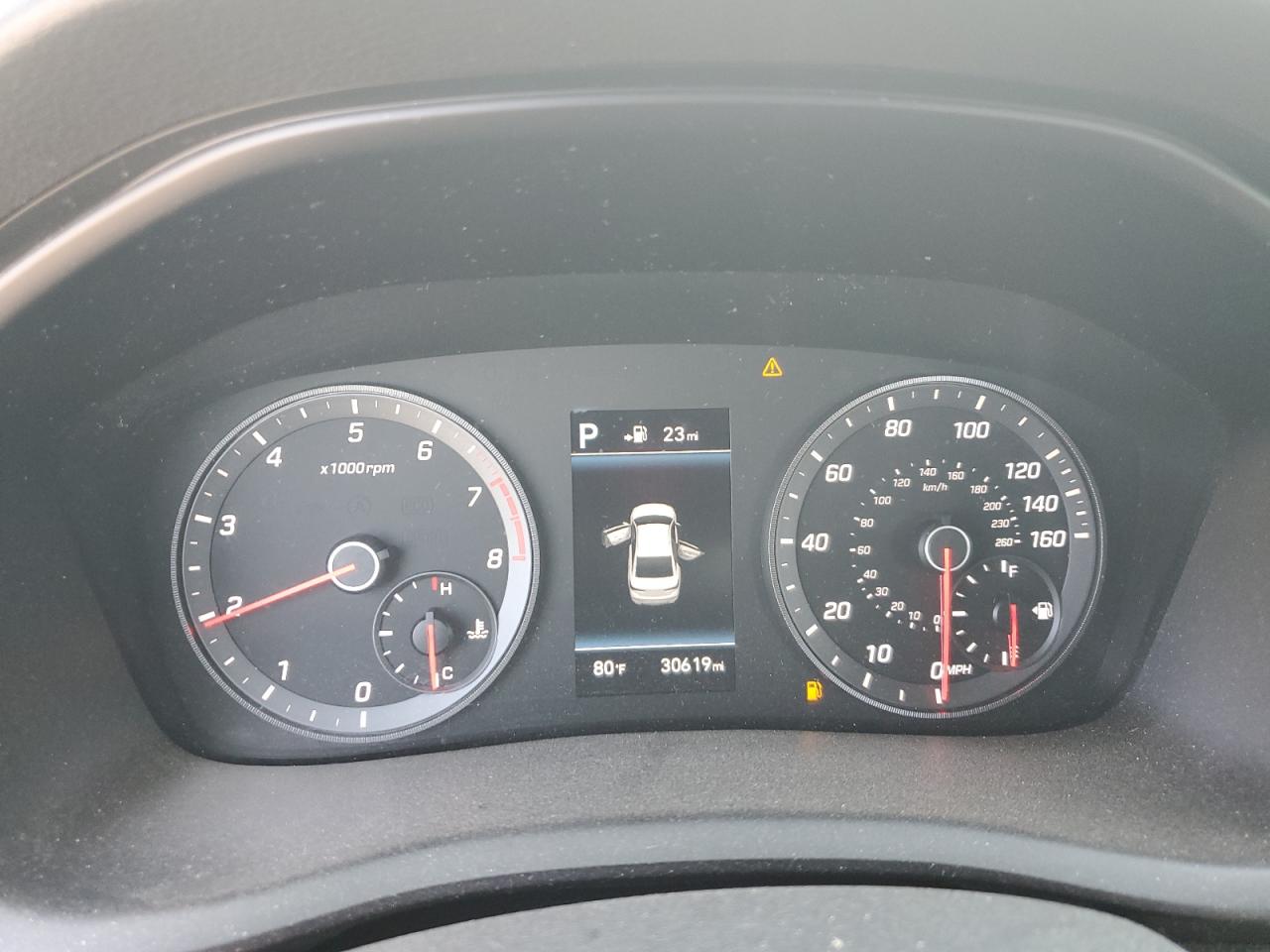 HYUNDAI SONATA LIMITED TURBO