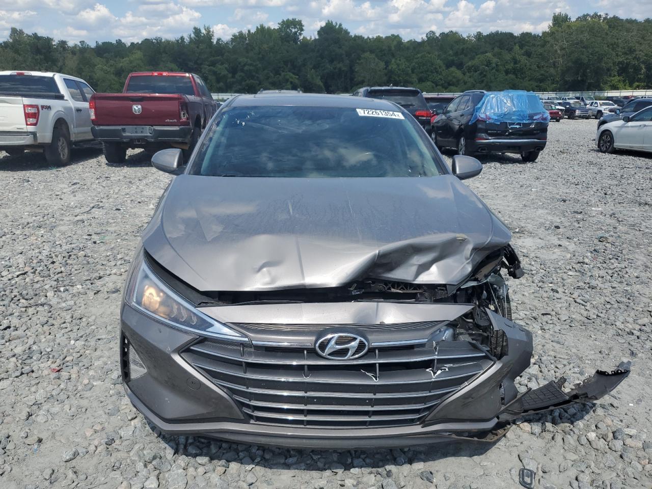 Lot #2921618659 2020 HYUNDAI ELANTRA SE