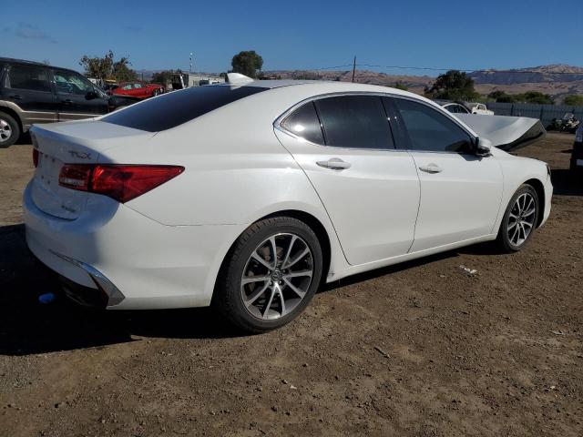 VIN 19UUB3F33JA002904 2018 Acura TLX no.3