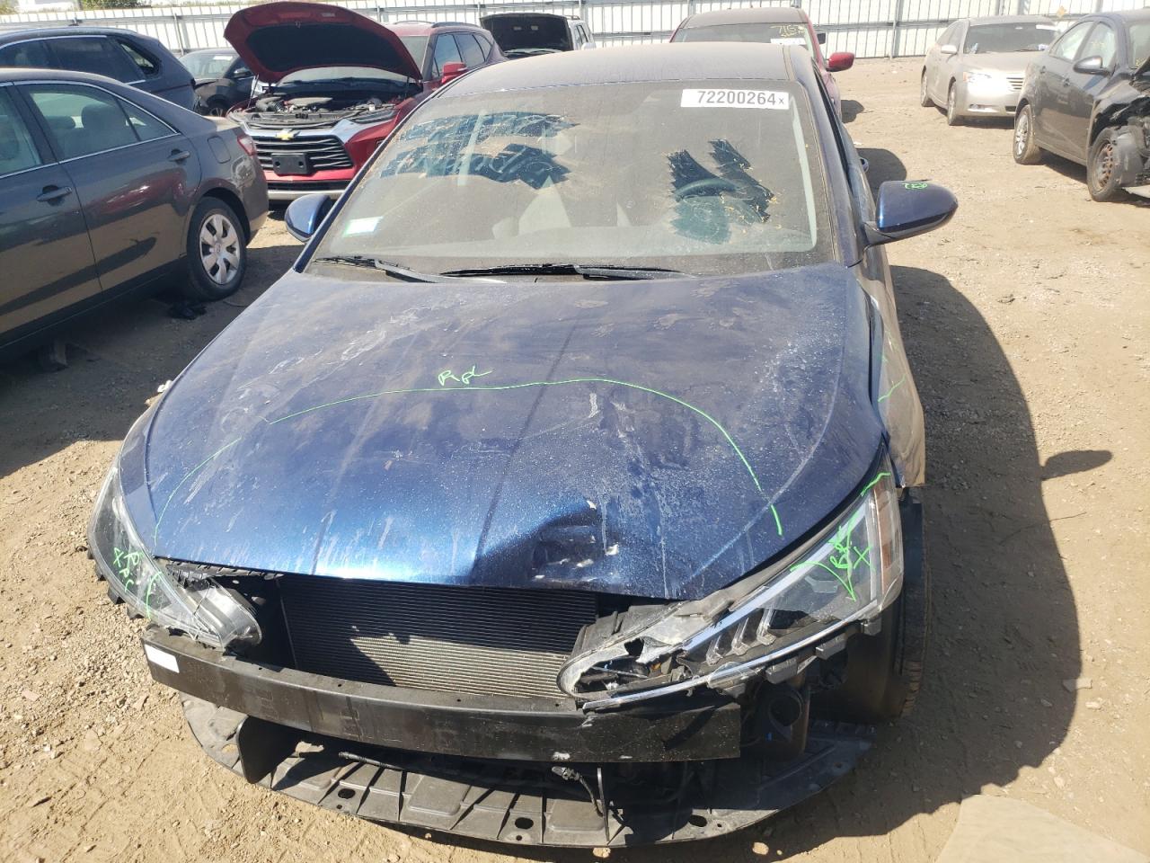 Lot #2923877866 2020 HYUNDAI ELANTRA SE