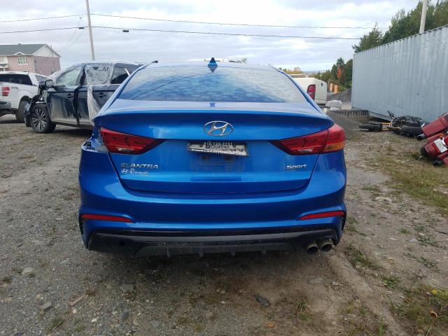2017 HYUNDAI ELANTRA SP KMHD04LB7HU324388