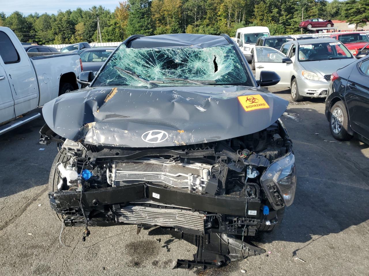 HYUNDAI KONA N LINE S