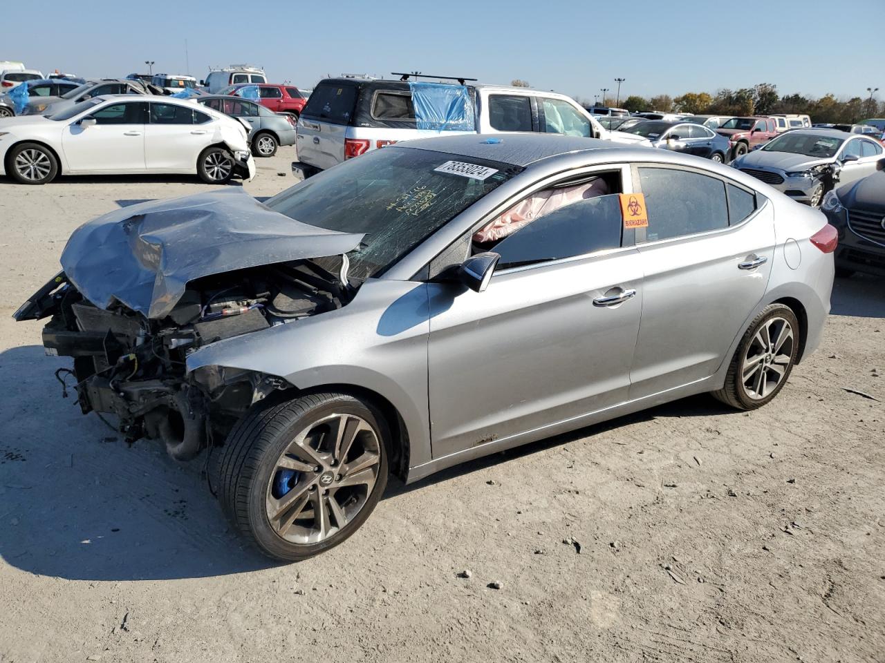 HYUNDAI ELANTRA SE