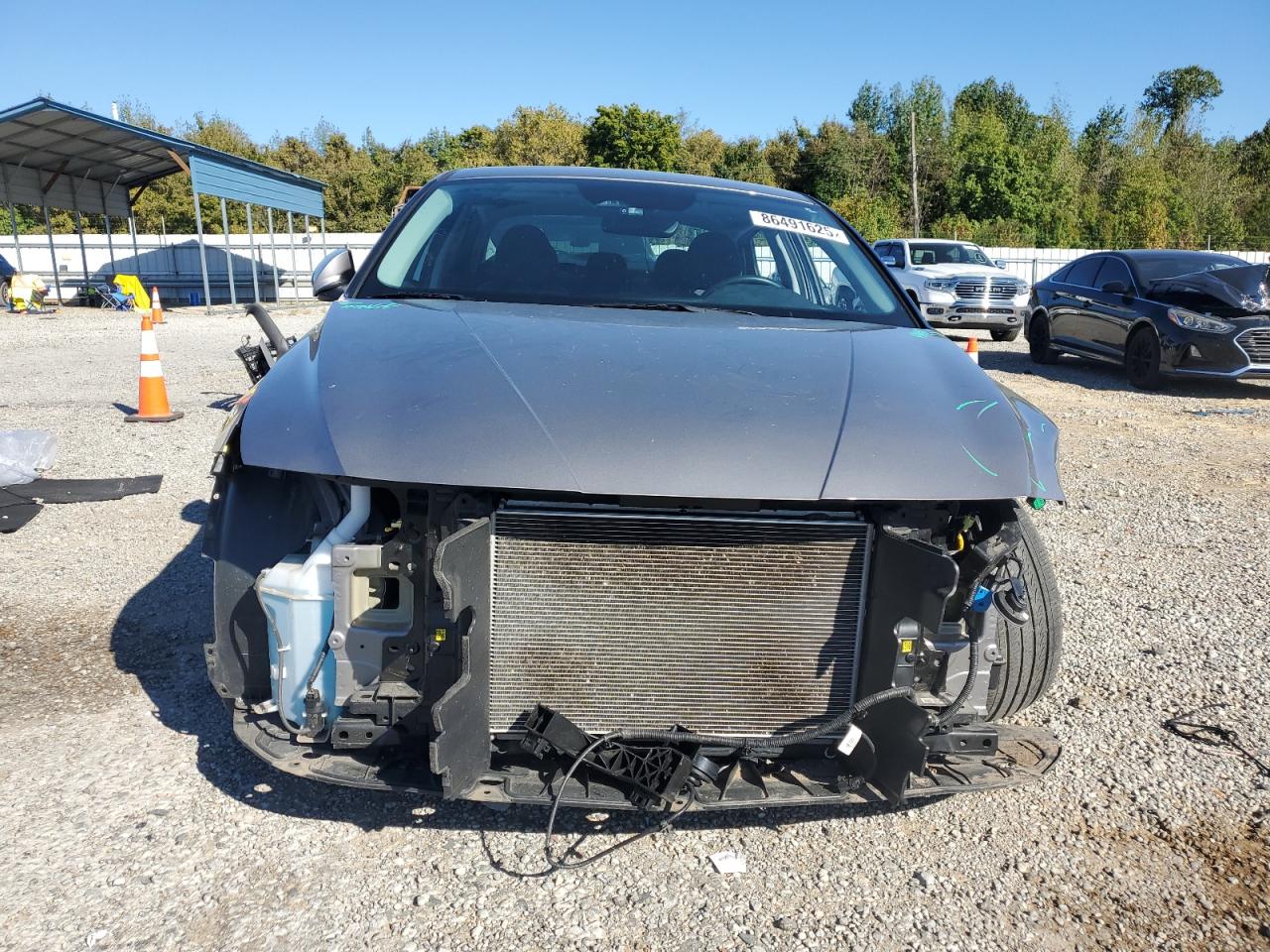 HYUNDAI ELANTRA LIMITED