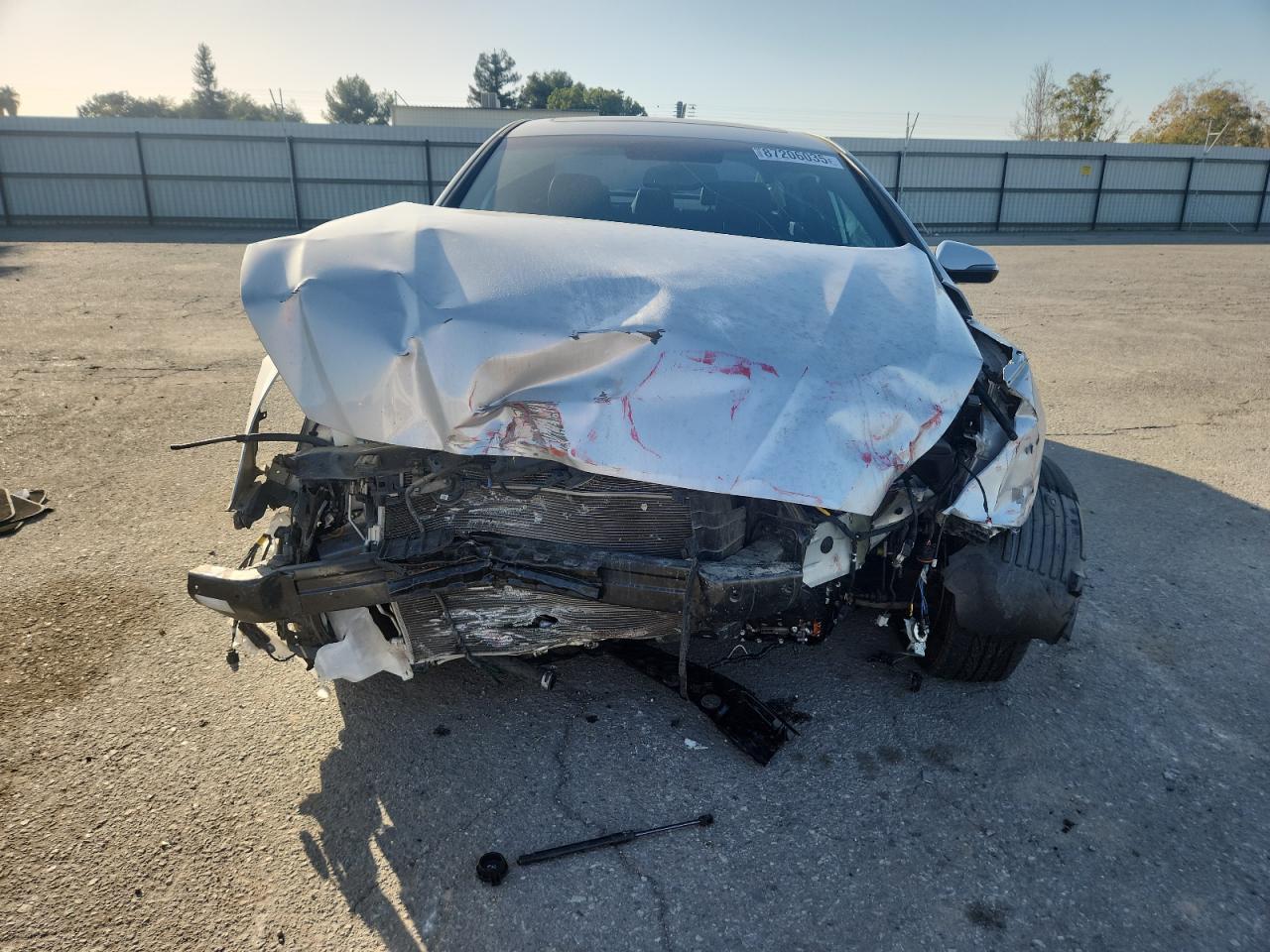 HYUNDAI SONATA LIMITED