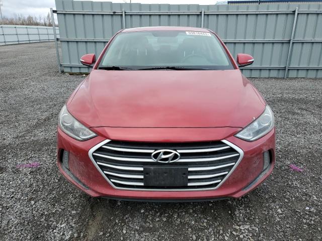 KMHD84LF6JU480889 | 2018 HYUNDAI ELANTRA SE