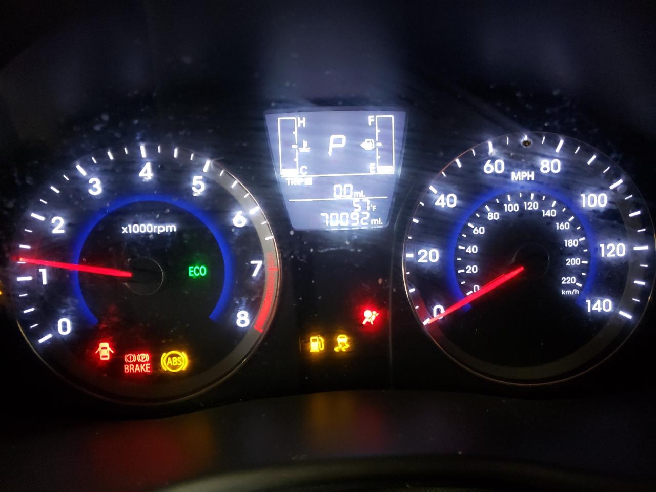 KMHCT4AE1HU283191 2017 Hyundai Accent Se