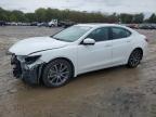 2017 ACURA TLX ADVANC - 19UUB3F71HA001571