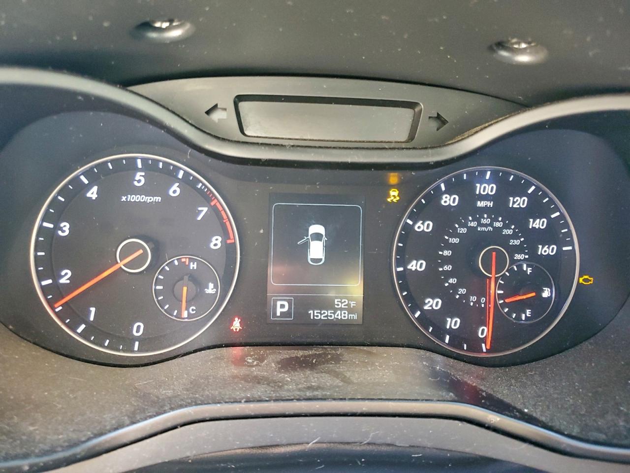 HYUNDAI VELOSTER TURBO