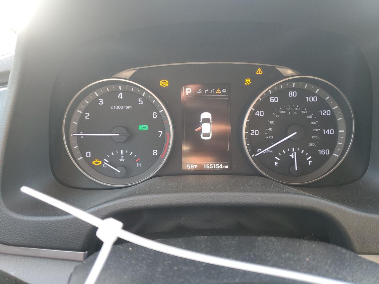 Lot #3304559474 2017 HYUNDAI ELANTRA SE