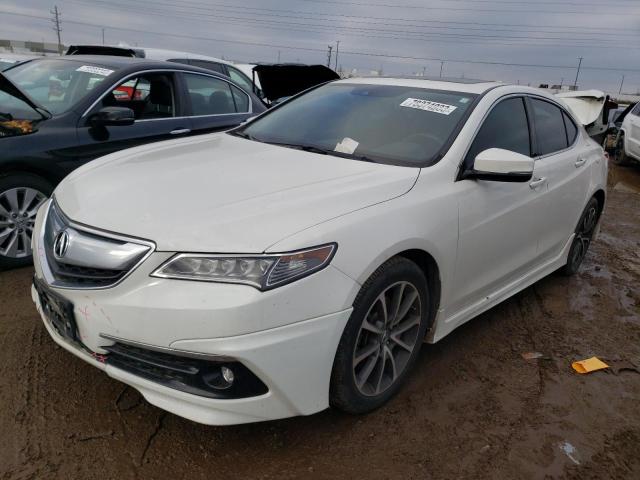 2017 Acura TLX Tech