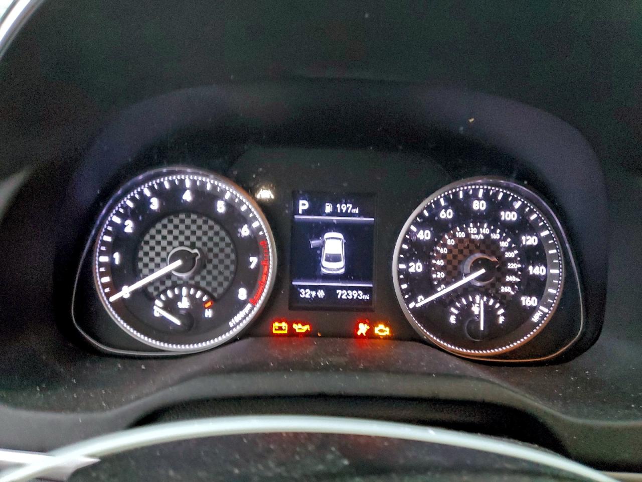 Lot #3308459308 2020 HYUNDAI ELANTRA SE