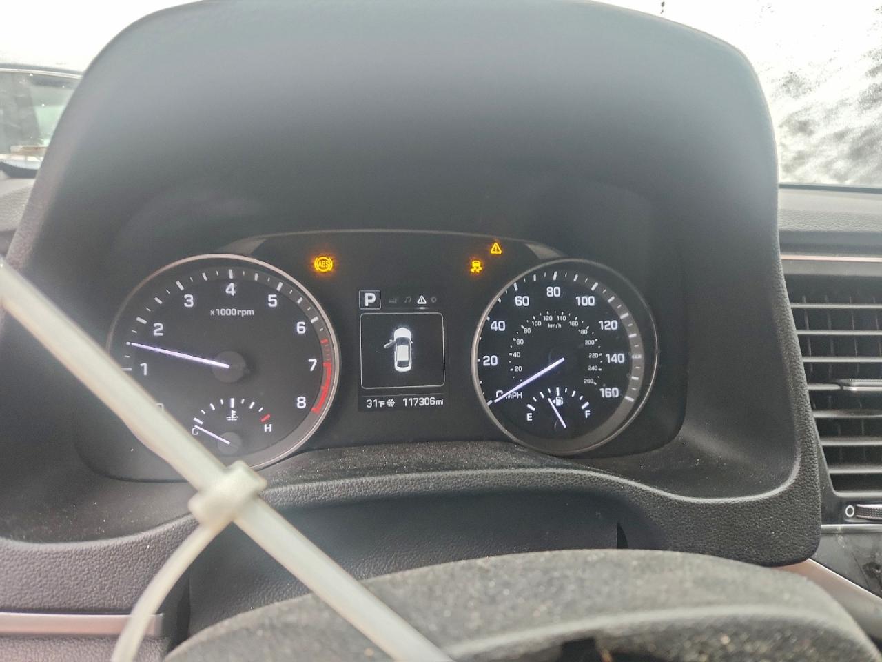 Lot #3311558269 2018 HYUNDAI ELANTRA SE